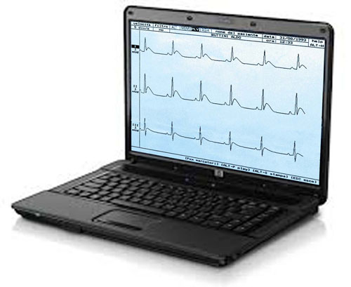 Elettrocardiografo