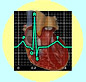 electrocardiograph